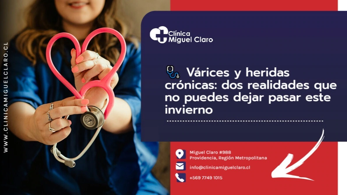 Várices y heridas Crónicas